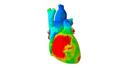 Living Heart - Dassault Systèmes